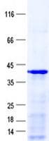 Human ZAR1L Protein (Recombinant His, N-Terminal)