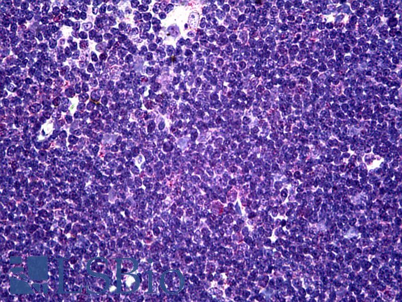 IHC-plus™ Monoclonal Mouse anti-Human CD58 Antibody (clone 2D11-B10, IHC, IF, WB)