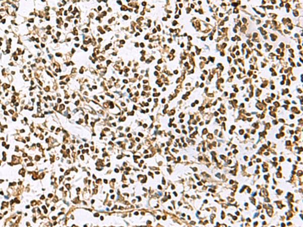 UBLCP1 Antibody