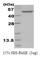 Human BHMT Protein (Recombinant His)