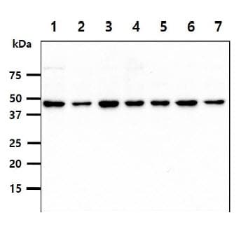 PSMD11 Antibody (clone AT2C7)