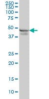 IHC-plus™ RPL4 / Ribosomal Protein L4 Antibody (clone 4A3)