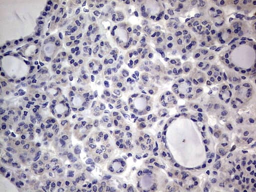PRX-1 / PRRX1 Antibody (clone OTI1E10)