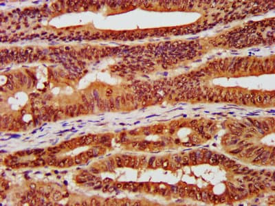 Polyclonal Rabbit anti-Human CSNK2A1 Antibody (aa1-391)