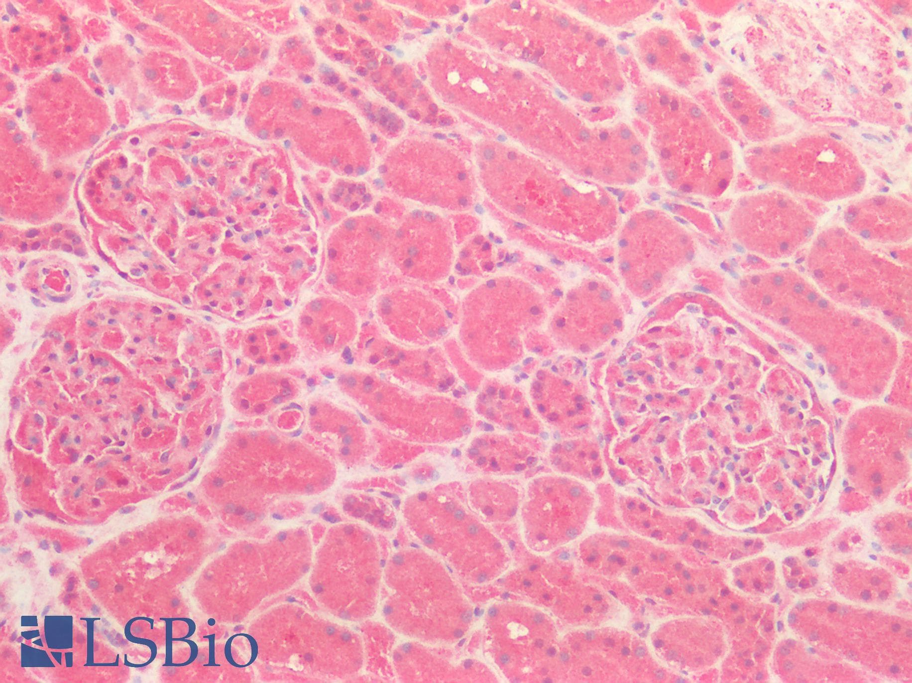 IHC-plus™ Polyclonal Rabbit anti-Human ICAM-1 / CD54 Antibody (IHC)