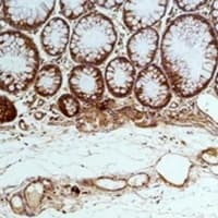 HSPA5 / GRP78 / BiP Antibody
