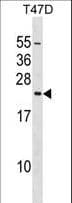 EIF3K Antibody (aa176-204)