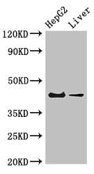 Polyclonal Rabbit anti-Human GPER1 / GPR30 Antibody (aa1-62, IHC, IF, WB)