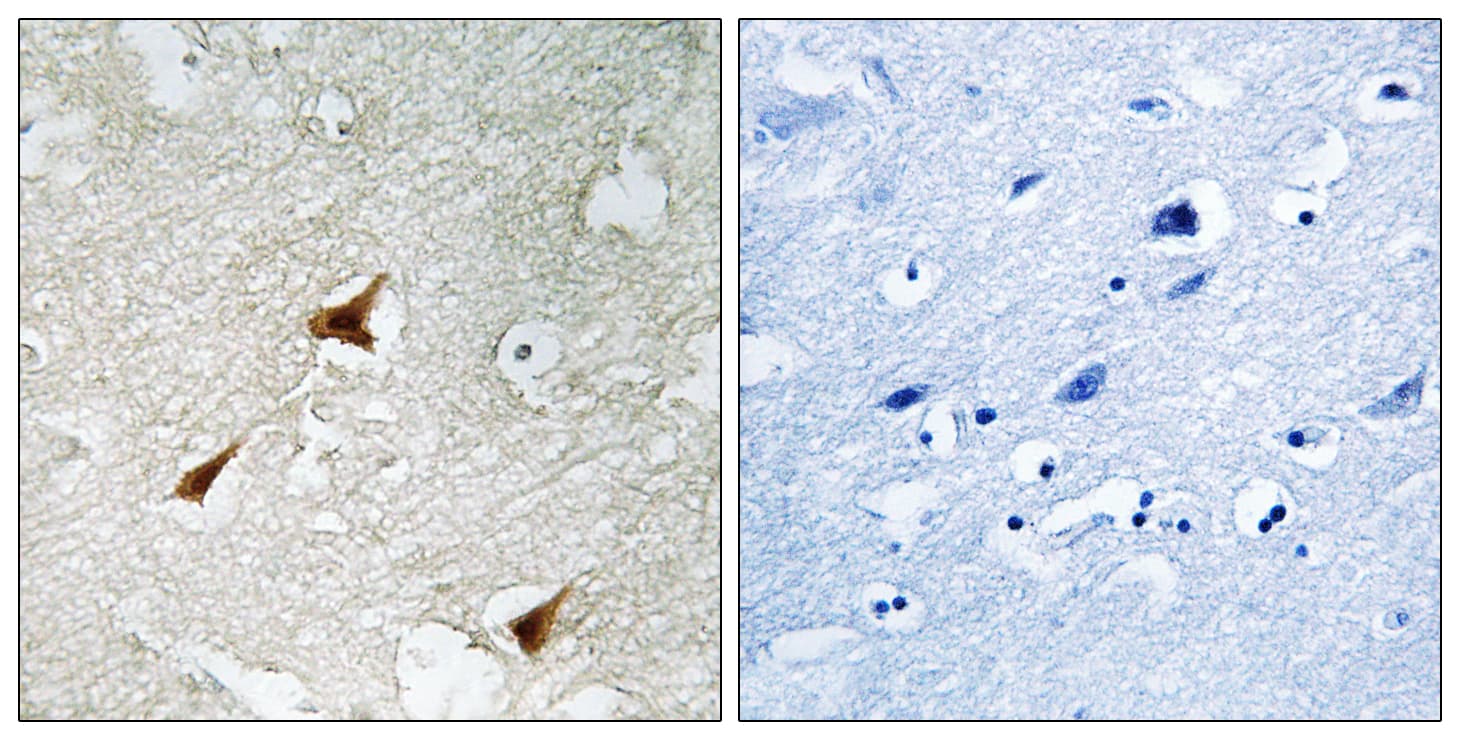 Polyclonal Rabbit anti-Human CDKN2D / p19 INK4d Antibody (aa96-145, IHC)
