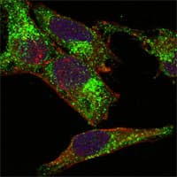 IHC-plus™ INHA / Inhibin Alpha Antibody (clone 4A2)