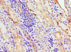 ANXA11 / Annexin XI Antibody (aa276-505)