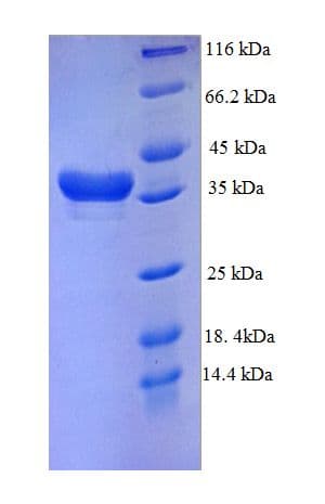 Human DTWD1 Protein (Recombinant GST)