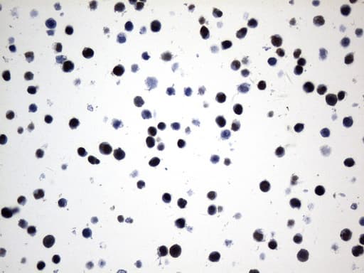 FOXP1 Antibody (clone UMAB242)