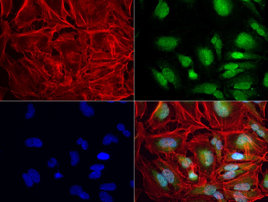 ERG Antibody (clone UMAB76, Carrier-free)