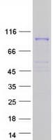 Human COPG2 Protein (Recombinant Myc-DDK (Flag))
