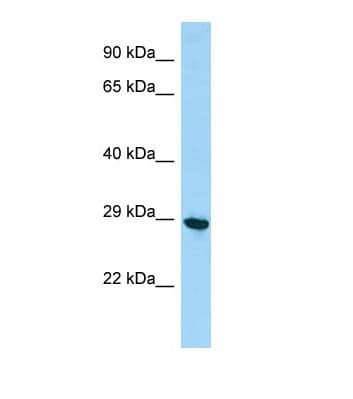 PHF7 Antibody (aa183-232)