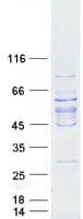 Human TCTE1 Protein (Recombinant Myc-DDK (Flag))
