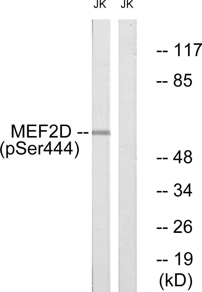 MEF2D Antibody (phospho-Ser444)