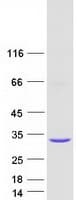 Human KCTD6 Protein (Recombinant Myc-DDK (Flag))