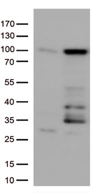 EWSR1 / EWS Antibody (aa256-447, clone OTI2B3)
