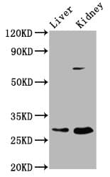PEX11A Antibody