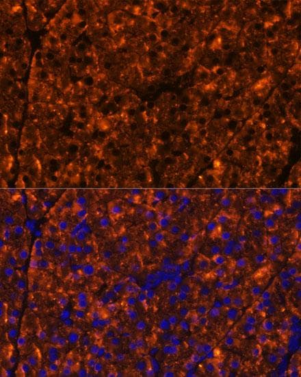 SERPINI2 / PANCPIN Antibody