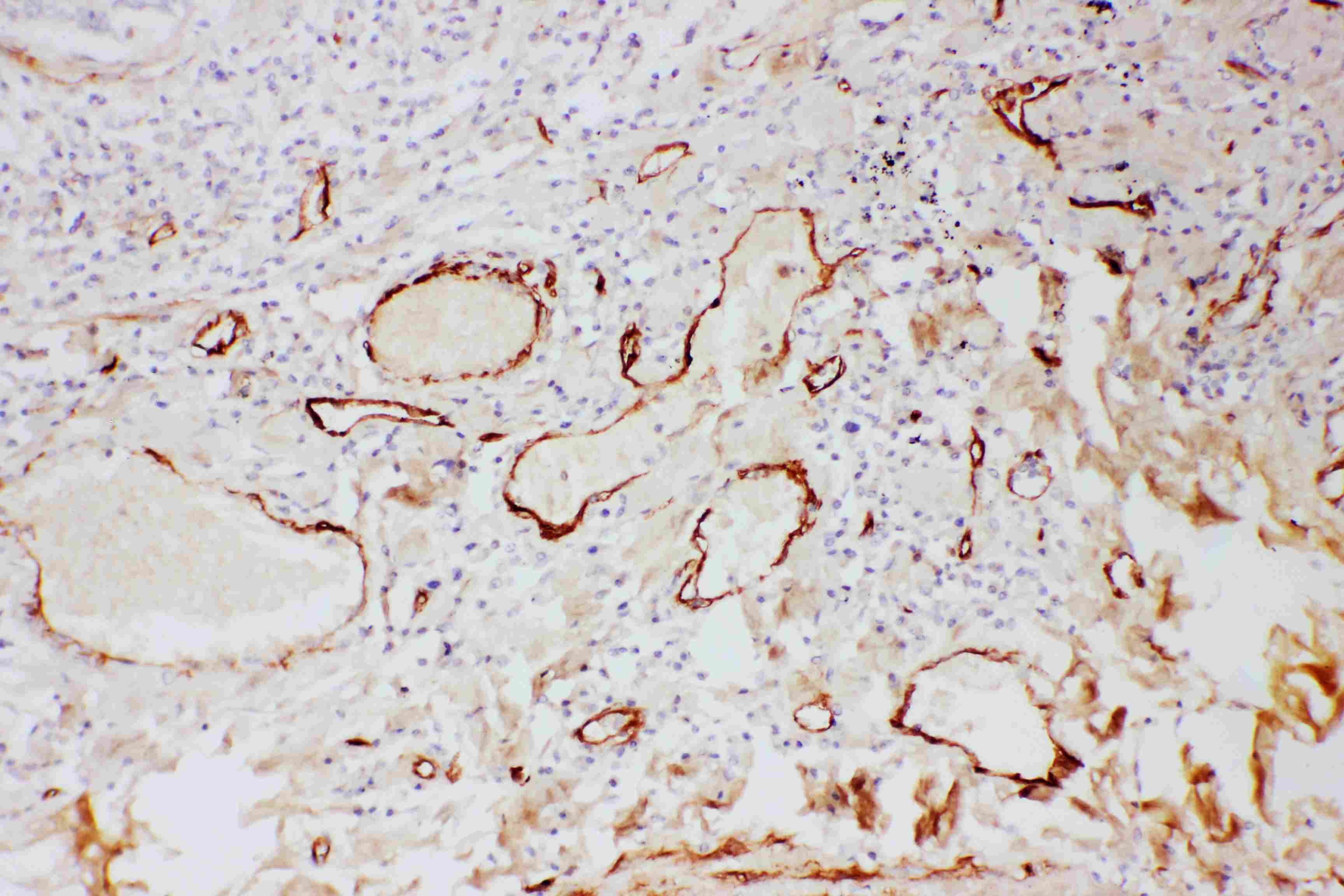 Polyclonal Rabbit anti-Human Adiponectin Antibody (aa19-244, IHC, WB)