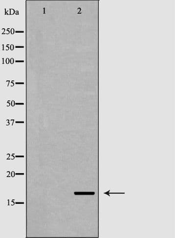 FGF1 / Acidic FGF Antibody