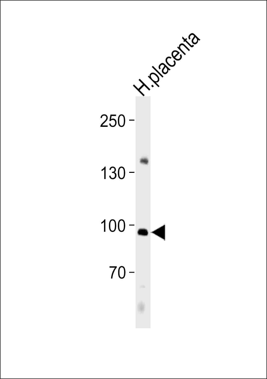 Polyclonal Rabbit anti-Human NFATC4 / NFAT3 Antibody (aa744-773, IF, WB)