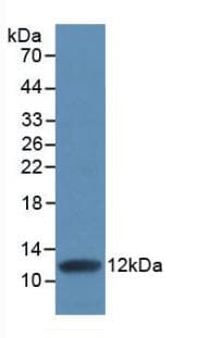 IL8 / Interleukin 8 Antibody (aa28-99, Cy3)