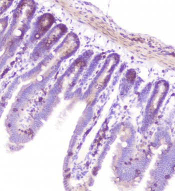 RASAL1 / RASAL Antibody