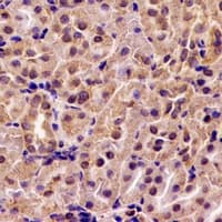 ABAT Antibody