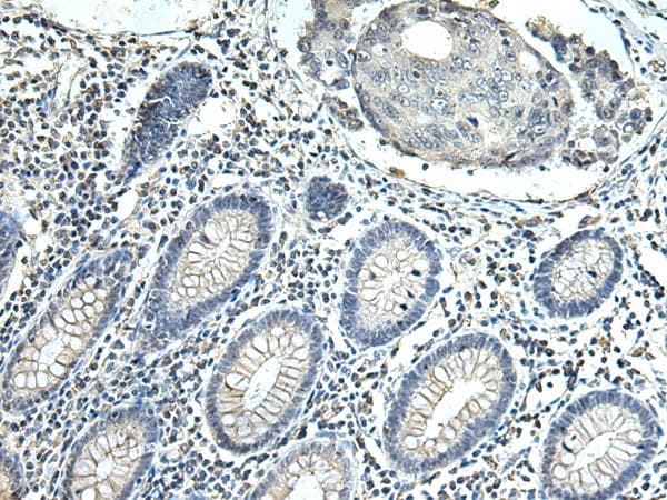 Polyclonal Rabbit anti-Human SLC35F6 Antibody (IHC)