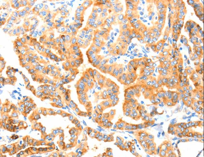 Polyclonal Rabbit anti-Human MANF / ARMET Antibody (IHC)