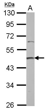 Polyclonal Rabbit anti-Human PRMT2 Antibody (WB)