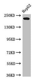 Polyclonal Rabbit anti-Human RAI1 Antibody (IHC, IF, WB)