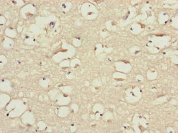 BLOC1S2 Antibody