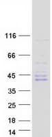 Human NEK6 Protein (Recombinant Myc-DDK (Flag))