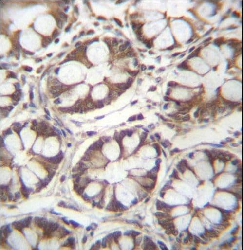 LAD1 Antibody (aa143-172)