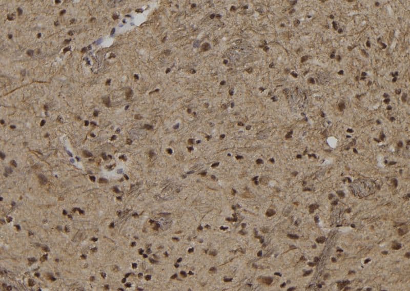 Polyclonal Rabbit anti-Human ZNF280B Antibody (IHC, WB)