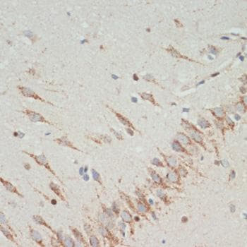TH / Tyrosine Hydroxylase Antibody