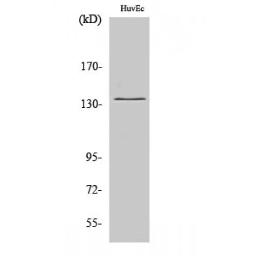 Polyclonal Rabbit anti-Human DGKD Antibody (10-90 aa, N-terminal, IHC, IF, WB)