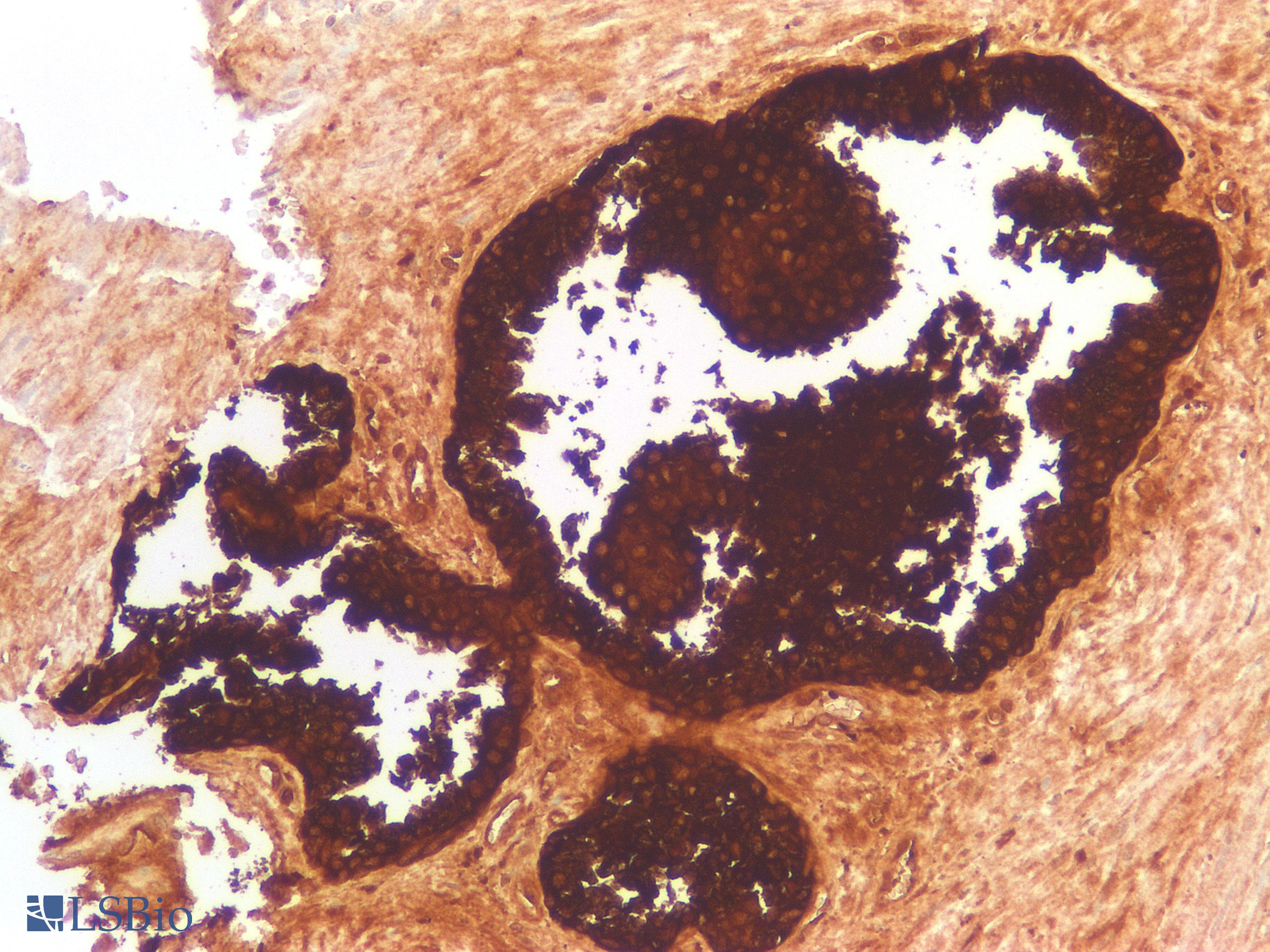 PathPlus™ PSA-ACT Complex Antibody (Concentrated)