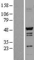 Human TADA3 / ADA3 Protein (Over-Expression Lysate Myc-DDK (Flag))