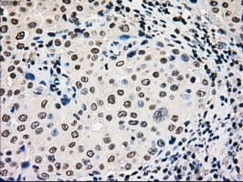 Monoclonal Mouse anti-Human GCK / Glucokinase Antibody (clone OTI3E3, IHC, IF, WB)