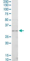 Monoclonal Mouse anti-Human CDK4 Antibody (clone 4F11, IF, WB)