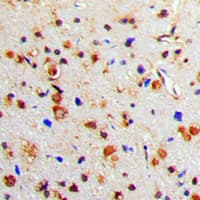 TH / Tyrosine Hydroxylase Antibody (phospho-Ser71)