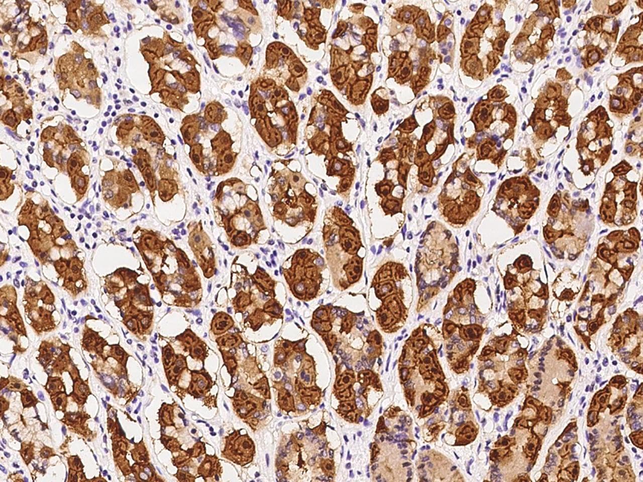C1orf116 Antibody