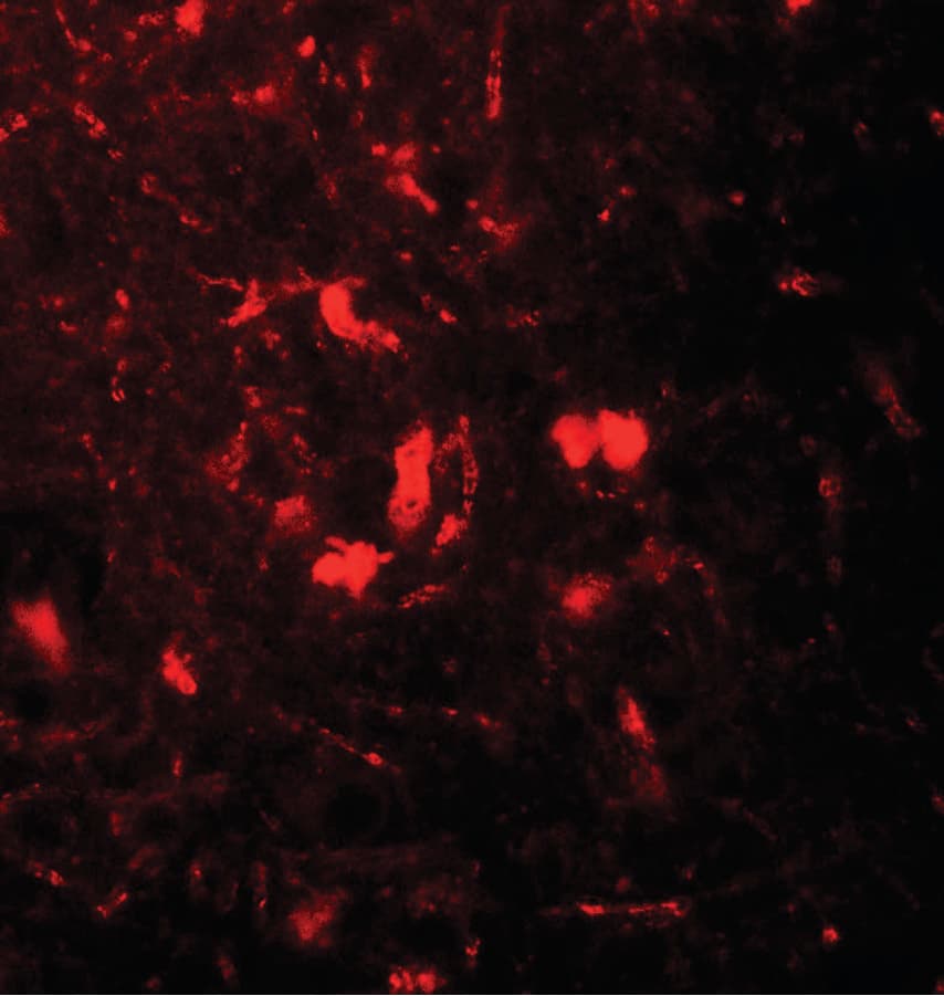 IHC-plus™ B2M / Beta 2 Microglobulin Antibody