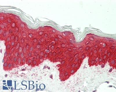 PathPlus™ KRT5 / CK5 / Cytokeratin 5 Antibody (510-590 aa, C-terminal)